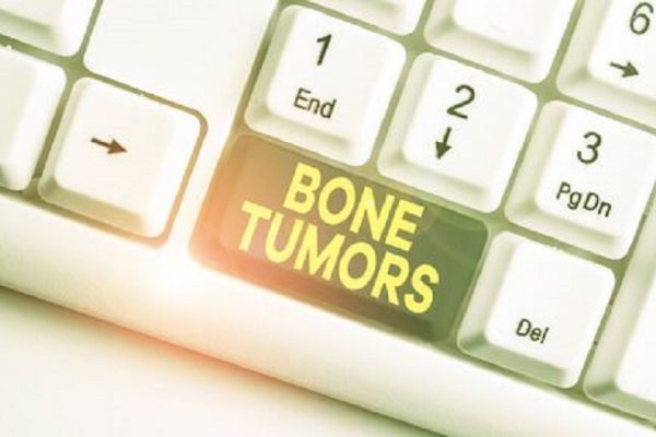 Different Types of Bone Tumors?